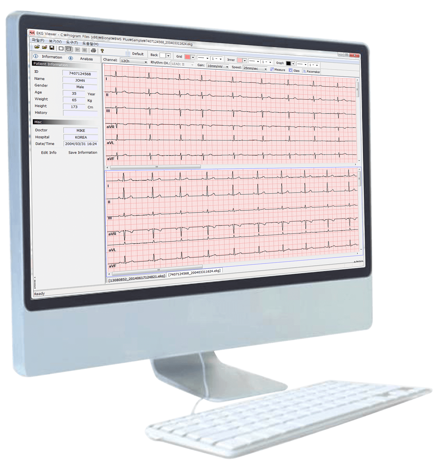 BMS-Plus Bionet EKG/ECG/Spirometer Software_slide