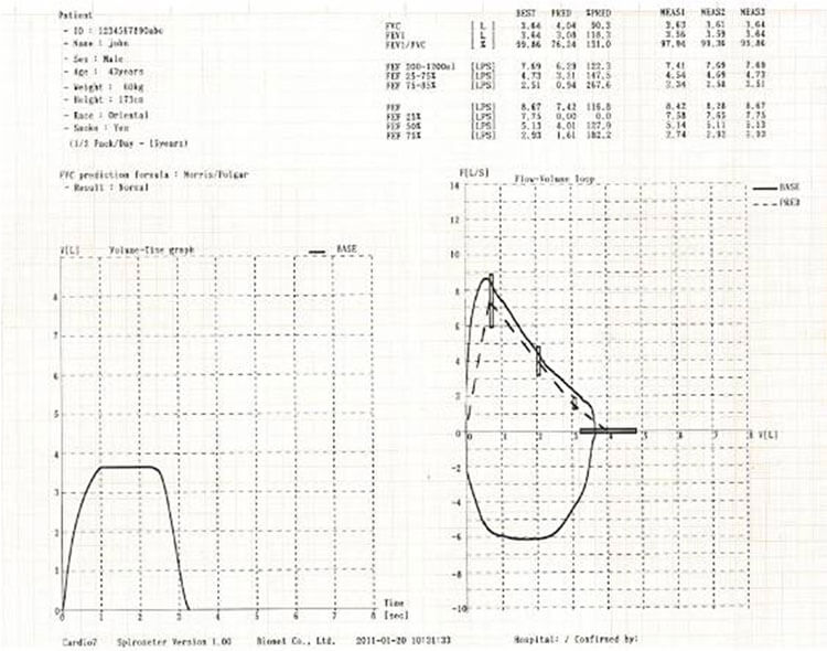 spm-300 fvc report spm-300 fvc report