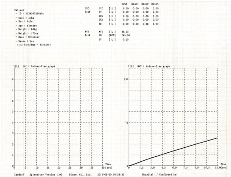 spm-300 mvv report spm-300 mvv report
