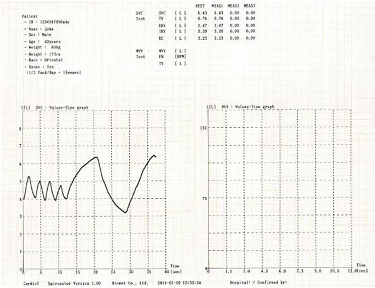 spm-300 svc report spm-300 svc report