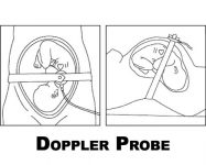 doppler probe